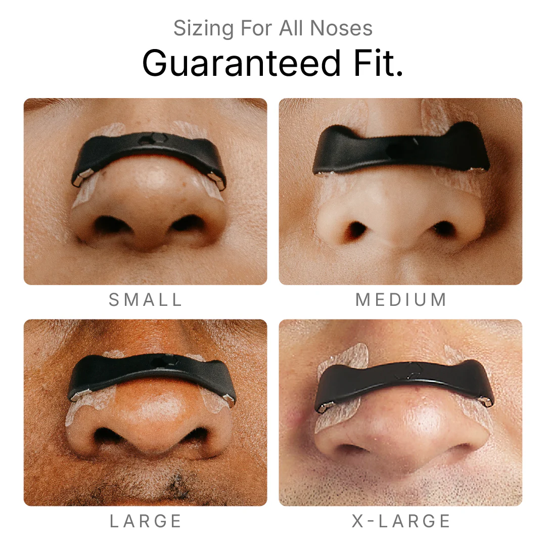 Intake Starter Kits - Image 4